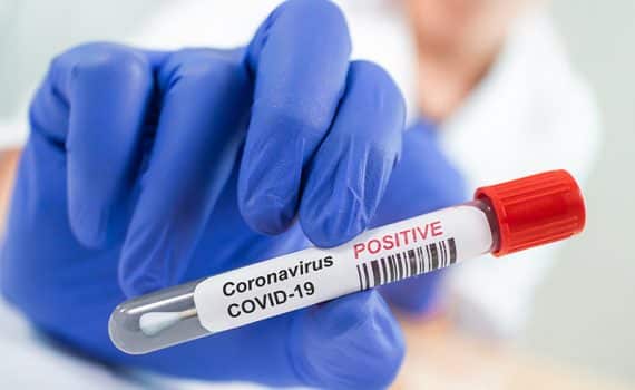 positive COVID-19 coronavirus test held by doctor who could explain unusual symptoms