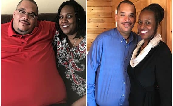 Couple Chuck and Caretha Coulter before and after pictures after weight loss surgery