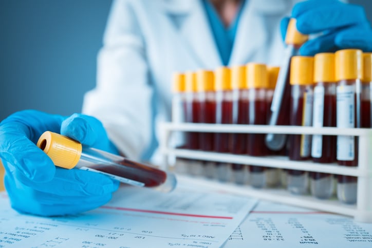 Blood vials in a lab