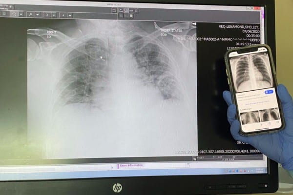 X-ray scans of a chest andl lungs