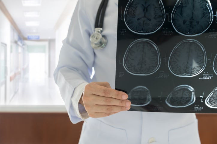 Stock image of a physician holding results of a brain scan 