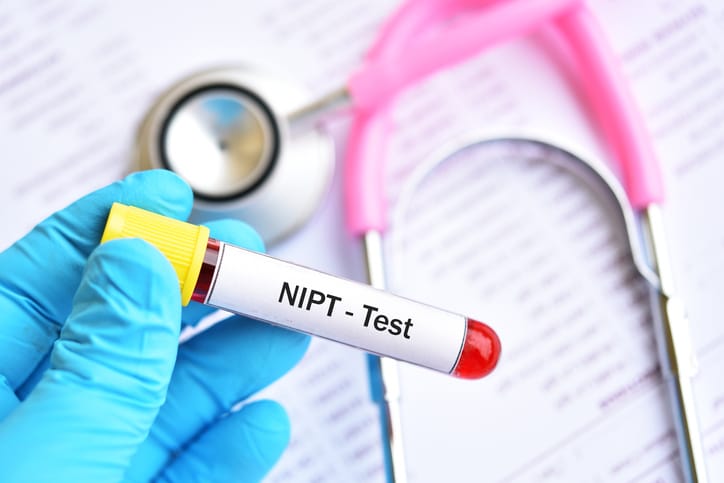 A stock image of a vial of blood with a label with the words "NIPT - Test"