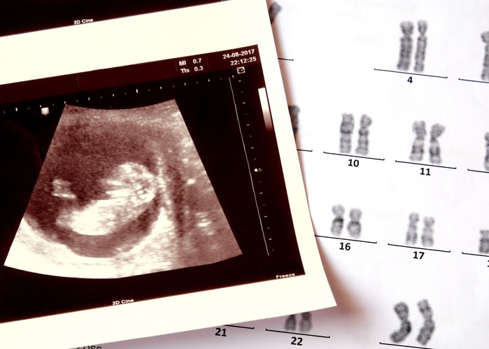 A stock image of a sonogram and a page with chromosomes listed out