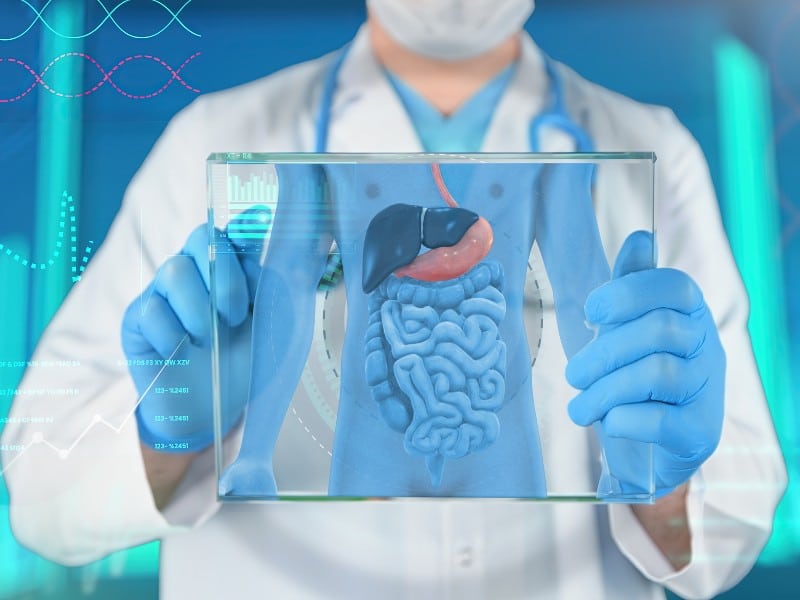 Stock photo of a medical professional holding up a teaching aid that shows the colon and digestive system, used to explain prevention for colon cancer