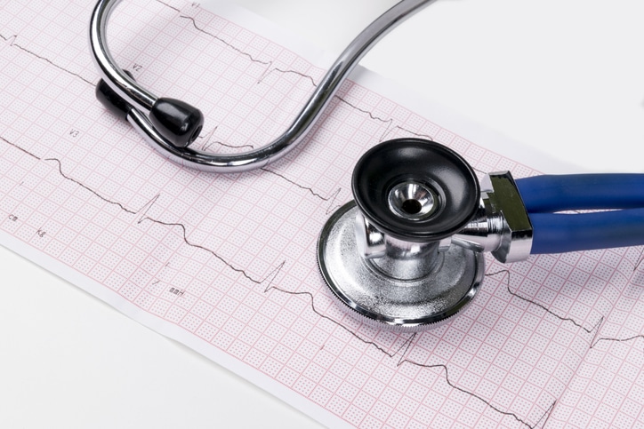 A stock image of a stethoscope and the results of an EKG on a table