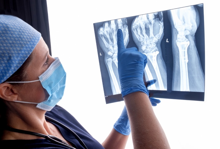 A medical provider wearing scrubs and a medical mask points to a set of X-rays