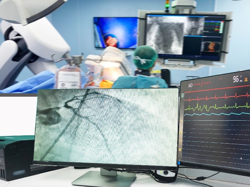 Image of a cath lab, used to explain the heart valve procedure known as TAVR