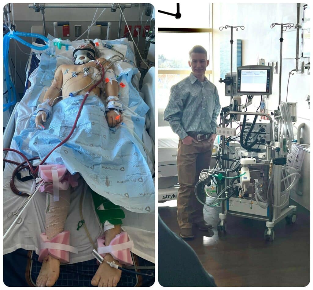 Garrett Blackmon photographed in the hospital after his accident and on the right duing his recovery from the crash and ECMO treatment