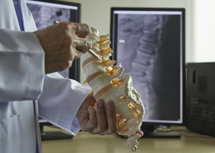 A stock image of a physician holding a model of a spine