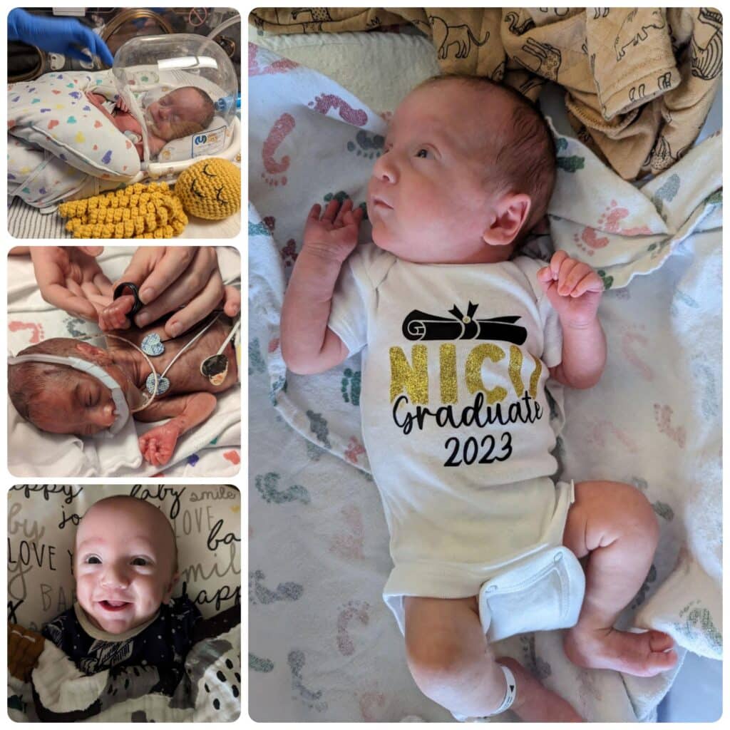 Various photos of preemie baby PJ after birth and a larger photo of JP in a onesie with NICU Graduate 2023 written on it