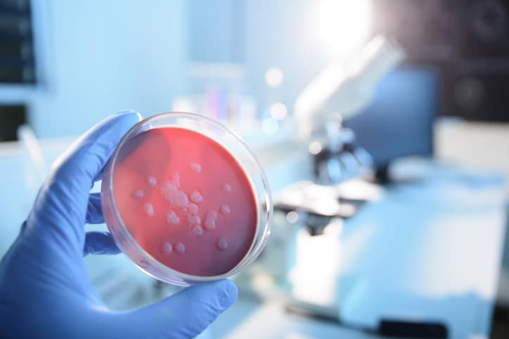 A stock photo of cultures in a lab