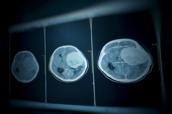 Three-panel CT scan images