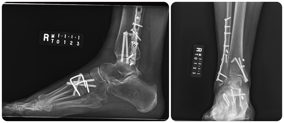 X-ray images of an ankle