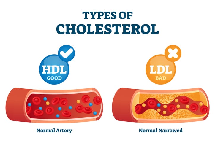 An educational graphic that explains the types of cholesterol, HDL and LDL