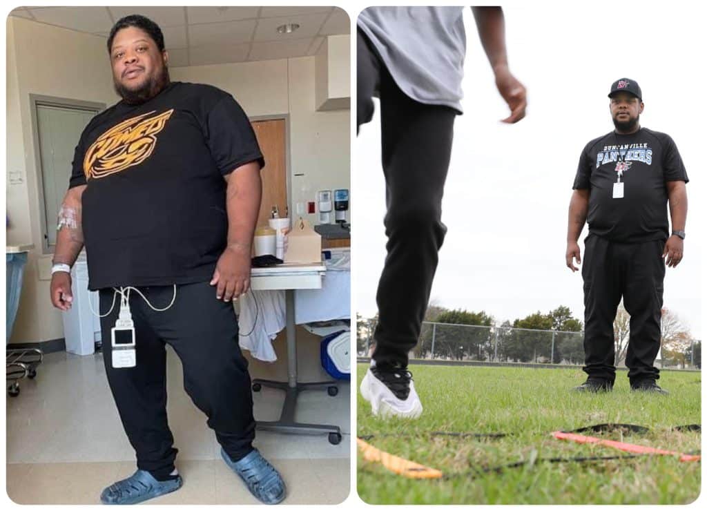 Two photographs of Tremont Davis before and after weight loss surgery