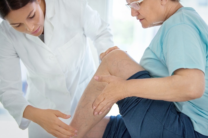 A woman provider in a white coat examine's an older woman's calf where veins are visible.