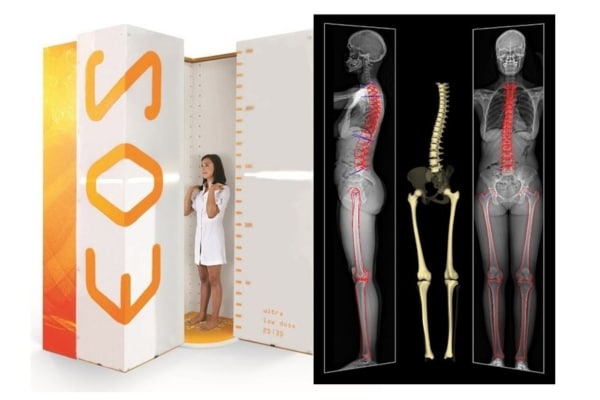 On left, a woman in a hospital gown stands in an orange-and-white cubicle with the logo EOS. On right, red and yellow images on a black background depict a skeleton.