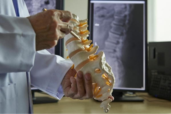 A medical provider holding a model of a spine