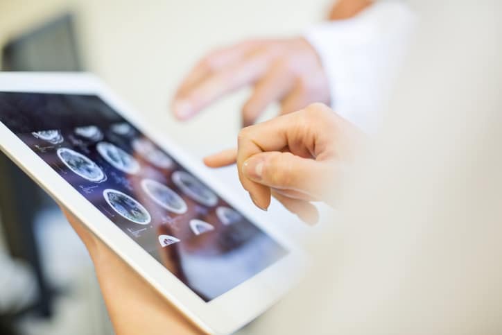 A close-up of brain scan images on a hand-held tablet