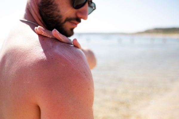 A man wearing sunglasses stands on a beach. He rubs lotion onto his shoulder.