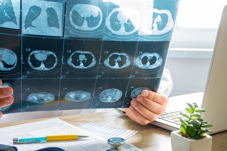 A person holding a series of CT scan results in front of them at a desk