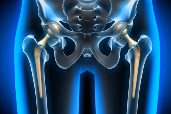 A medical diagram of the torso and hip bones