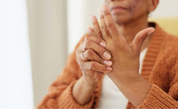 Arthritis is among the many possible symptoms of lupus.