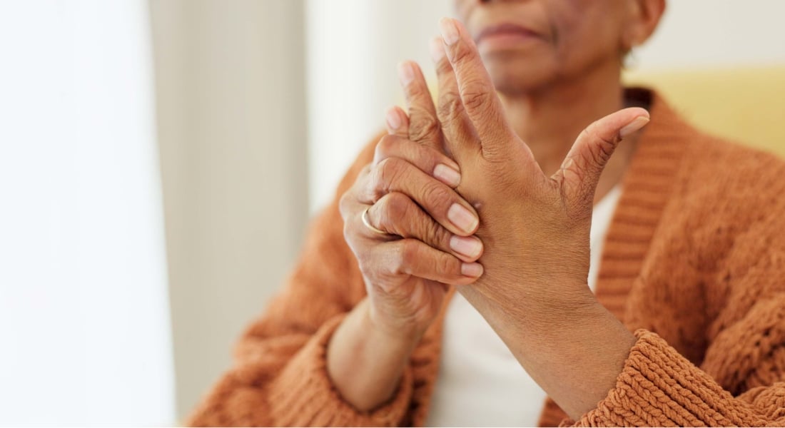 Arthritis is among the many possible symptoms of lupus.