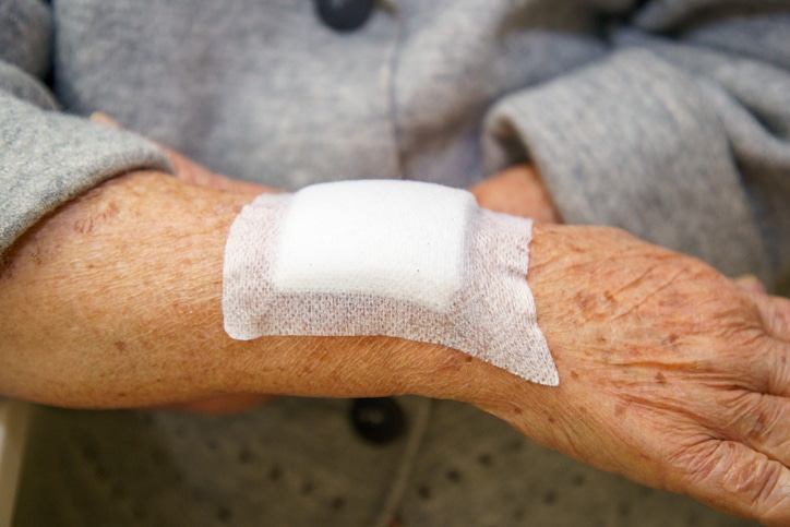 Close up old woman hand or arm to the wounded waiting for nurse treatment.