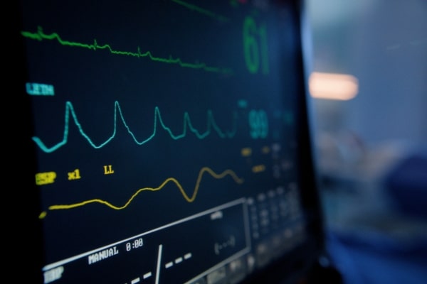 A monitor tracks the vital signs of a patient in a hospital.