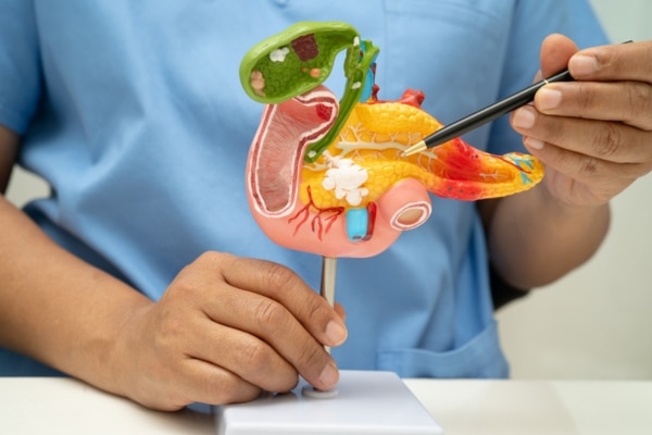 A doctor points to a model of the pancreas.