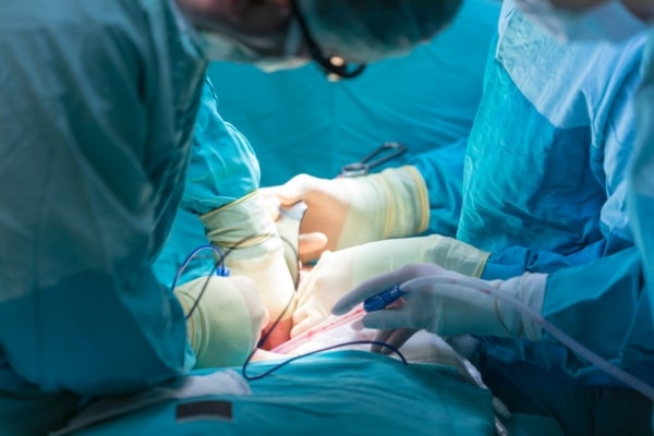 Minimally invasive surgery being performed by a cardiologist