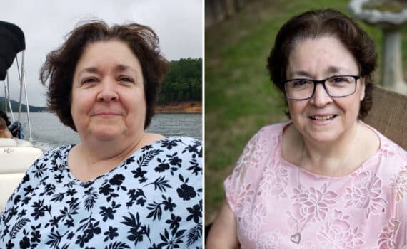 A collage shows Christine Morris before and after weight loss surgery.