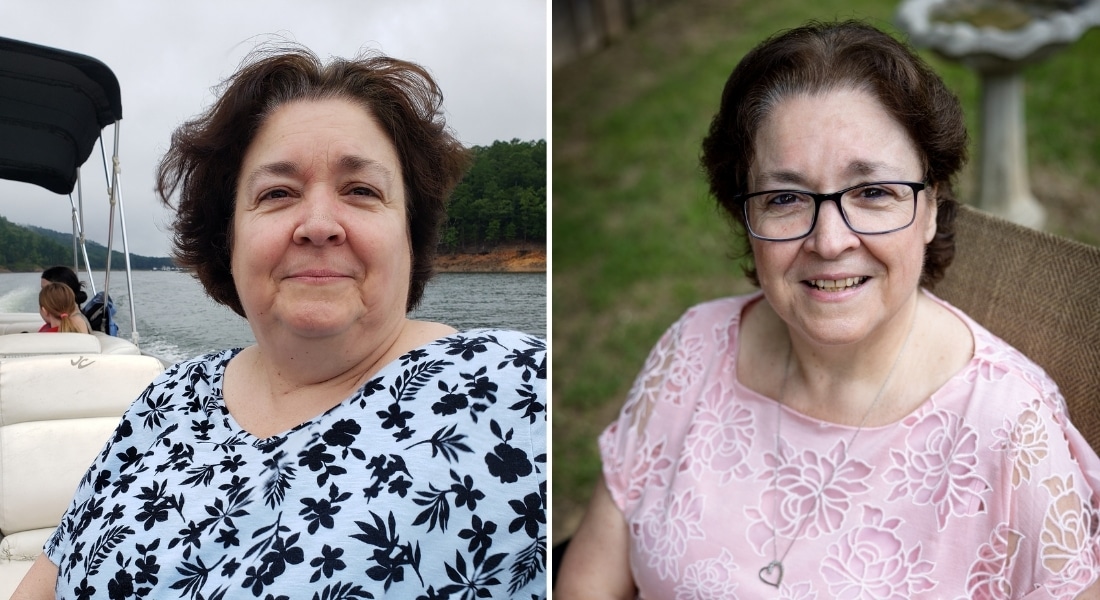 A collage shows Christine Morris before and after weight loss surgery.