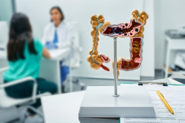 A doctor talks to a patient in the background with a model of a colon in the foreground