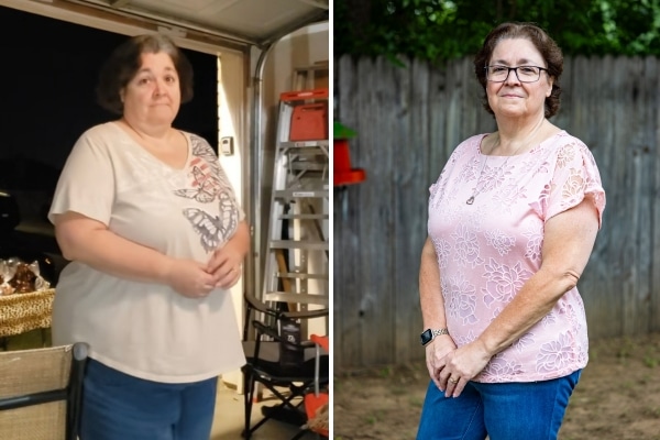 A collage shows Christine Morris before and after weight loss surgery.