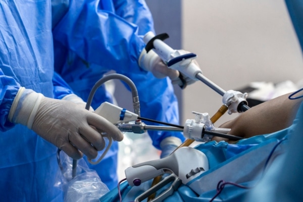 Doctors perform laparoscopic surgery on a patient with an inflamed gallbladder.