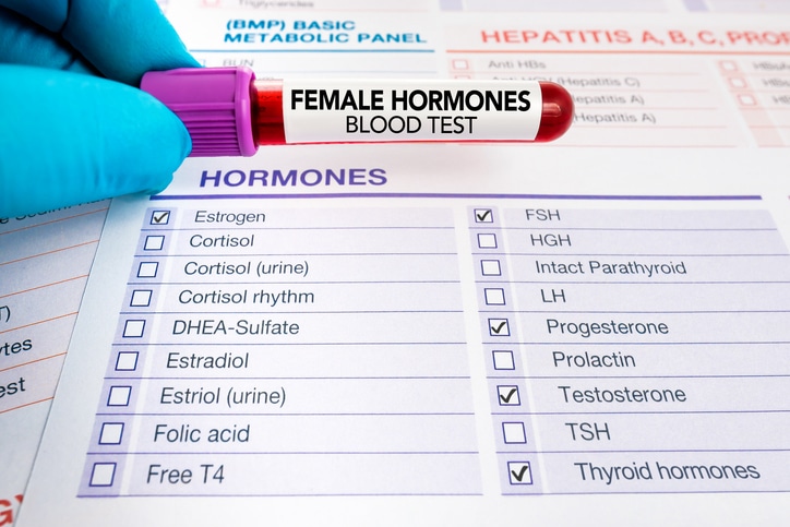 Requisition form with blood test check for study of levels of hormones for woman, doctor holding blood sample for analysis of Female Hormones test