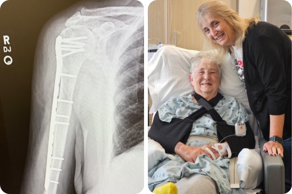 An X-ray shows Doris Potter's broken right arm on the left, and a second photo shows Doris and her daughter Brenda in the hospital.