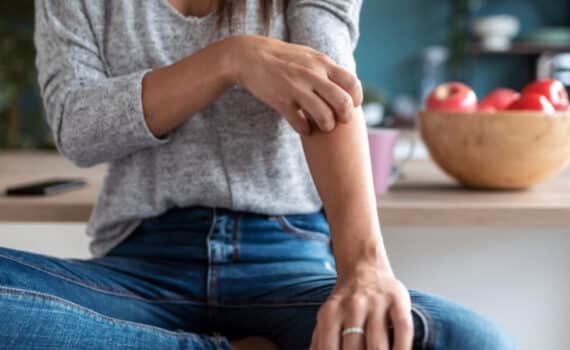 A woman scratching her arm, used to express psoriasis