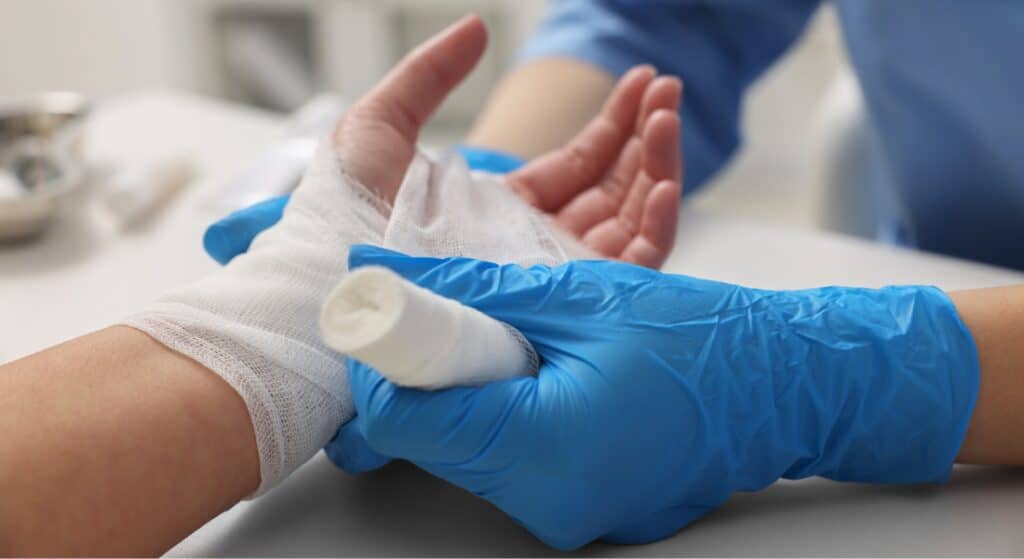 A doctor wearing blue gloves wraps the hand of a burn patient.