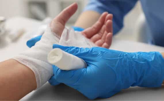 A doctor wearing blue gloves wraps the hand of a burn patient.
