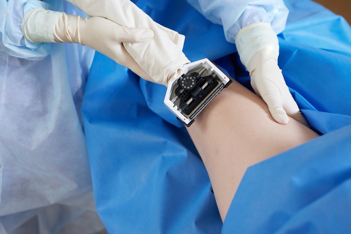 A doctor performs a skin graft in clinic or hospital.