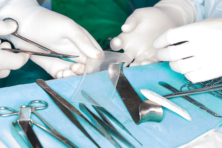 A surgeon cuts up mesh for a hernia repair.