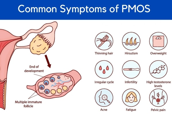 A graphic shows the common symptoms of PMOS