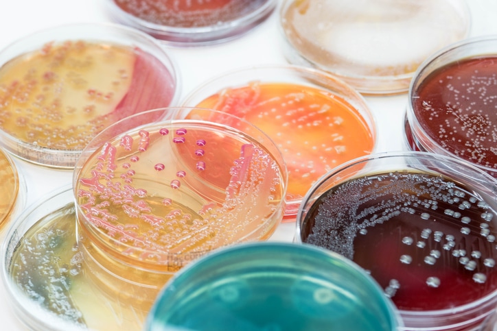 Bacterial colonies culture grow in petri dishes.